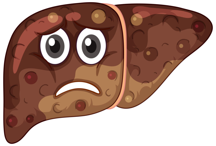 liver-cancer-can-it-be-inherited-myprecisedna